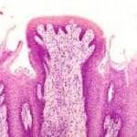 Fungiform papillae