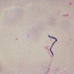 Hemolytic Streptococcus