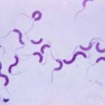 لام اسپریلوم انواع باکتریهای مارپیچی گرم منفی