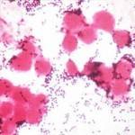 staphylococcus aureus