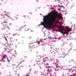 streaptococcus Griseus