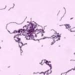 streaptococcus pyogenes