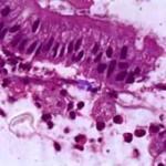 لام انگل آنتاموبا هیستولیتیکا در بافت رودهEntamoeba in intestine  slide