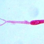 Schistosoma_mansoni-cercaria