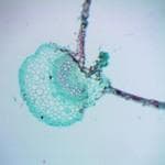 phytophora infestans 2